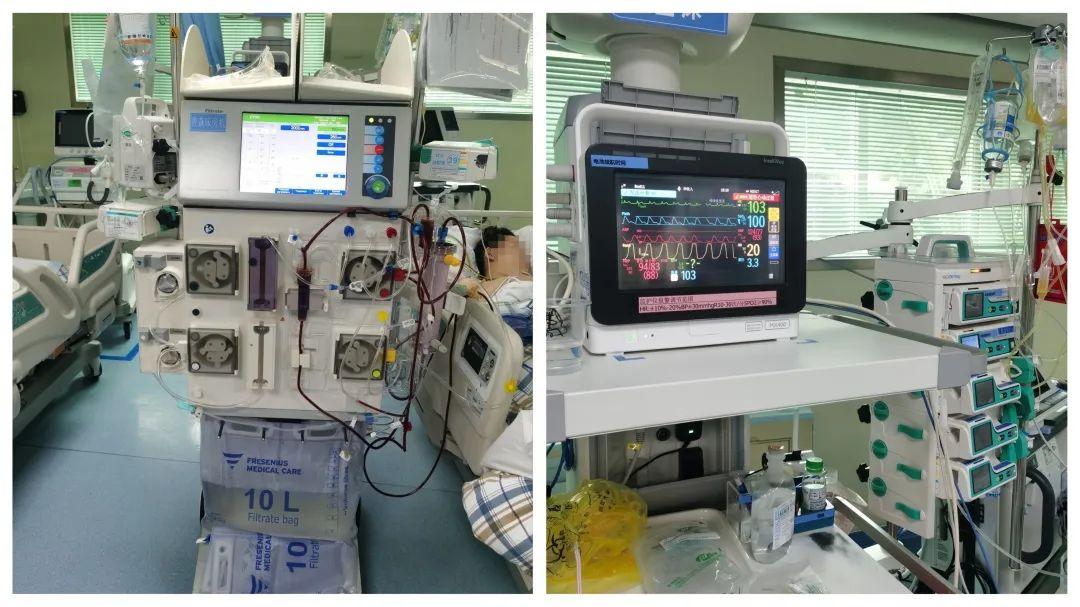 icu内给予血液灌流 血液净化以及输血治疗