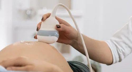 麻醉泵是什么“用了无痛分娩的妈妈，没有一个后悔的”_https://www.jmylbn.com_新闻资讯_第12张