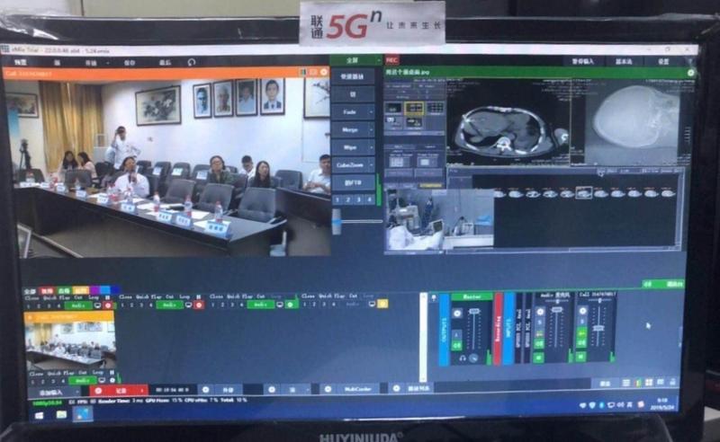 全国首例！深圳联通助力5G远程微创介入“一对多”指导手术成功
