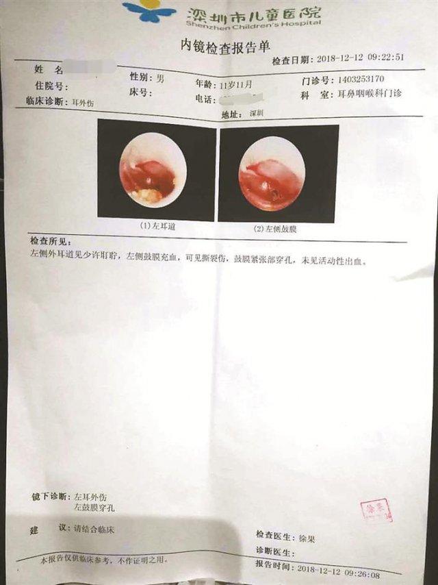 体育教师殴打小学生致耳鼓膜穿孔涉事各方尚未达成赔偿共识
