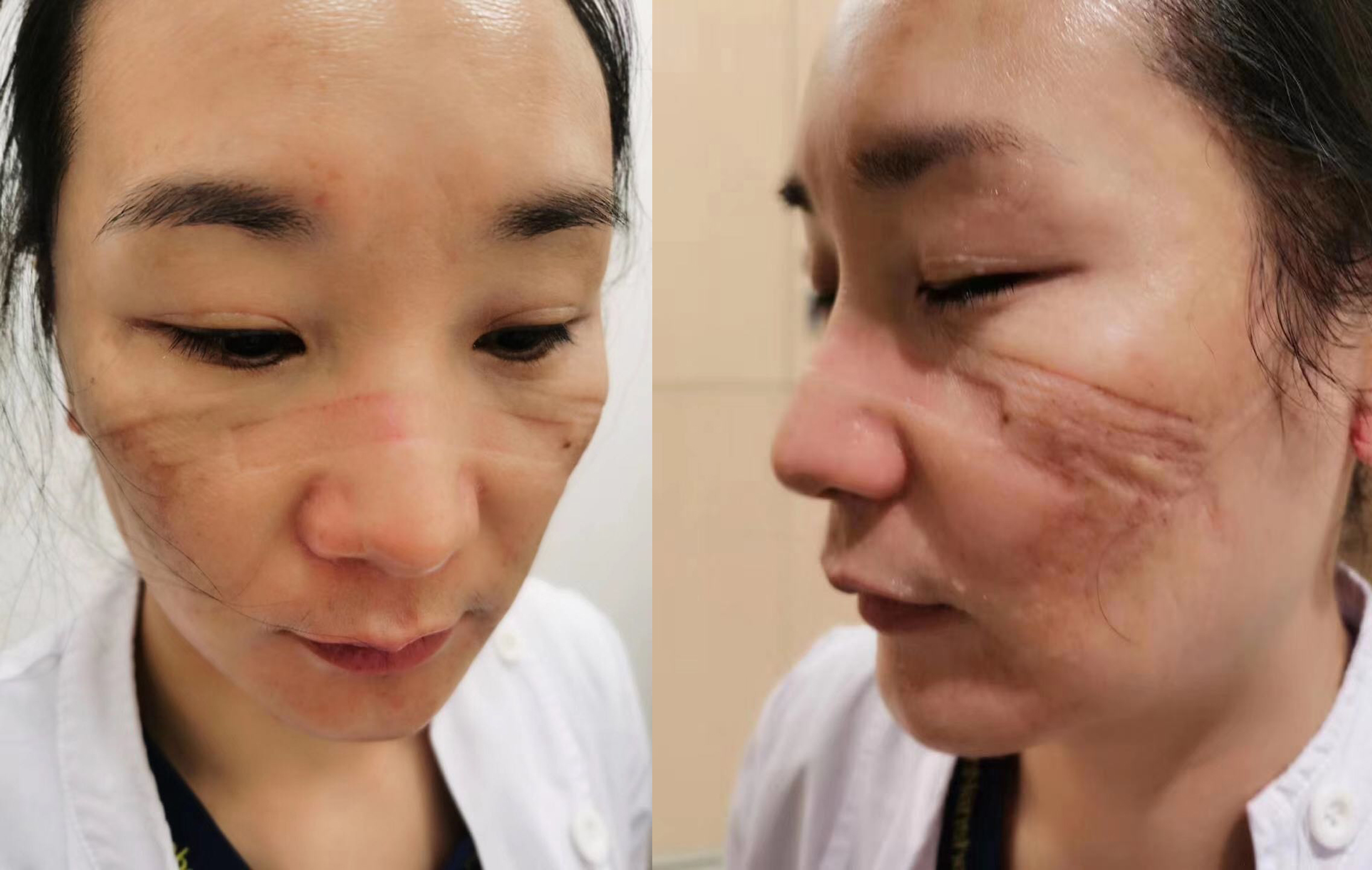 战疫期间南山一线医务人员让人感动的十个瞬间