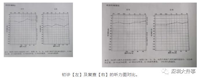 辅导作业太生气,深圳父亲打儿子一耳光!结果出事了…网友:忍住