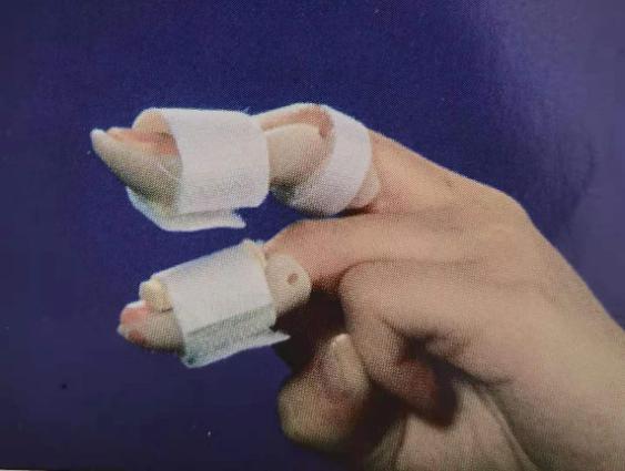 龙华区中心医院康复工程支具室正式开诊