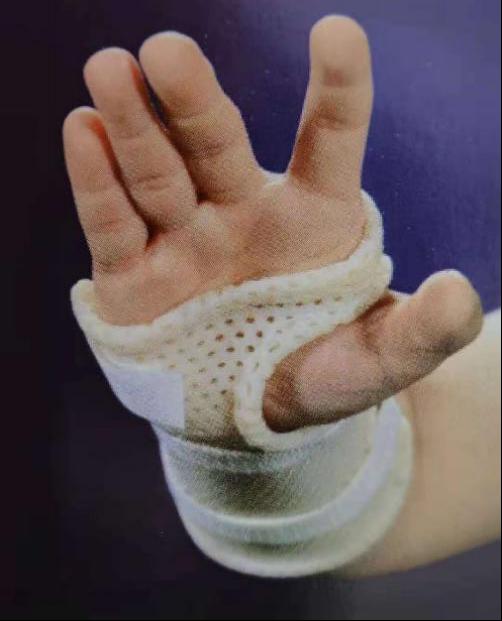肌腱损伤等矫形手术后的固定及治疗手指关节渐进性屈曲拉伸支具⑧肢体
