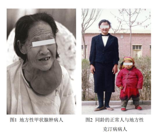 碘缺乏的原因及危害_深圳新闻网