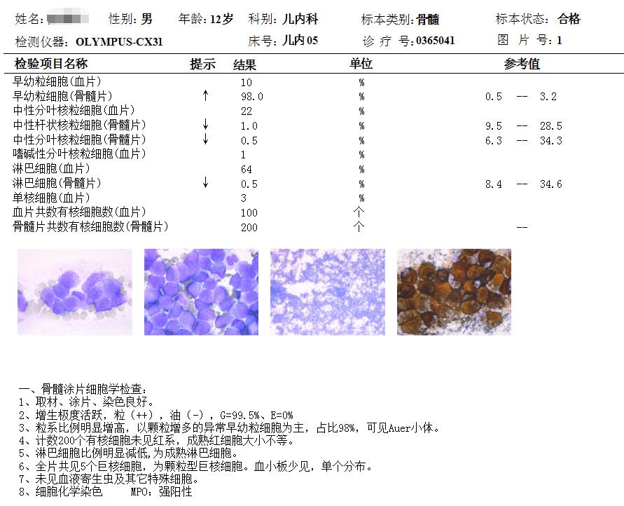仁医巧用药患儿喜得救龙华区中心医院成功治愈急性早