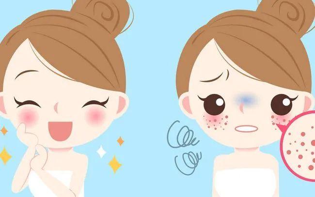 治未病之女性健康调养篇丨黄褐斑,毁颜值,中医美容疗法,很有用!