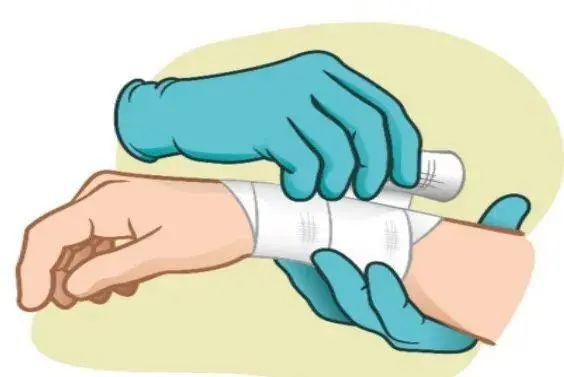 要进行伤口护理有的还得申请住院但家属往往不专业清洁,消毒,换药