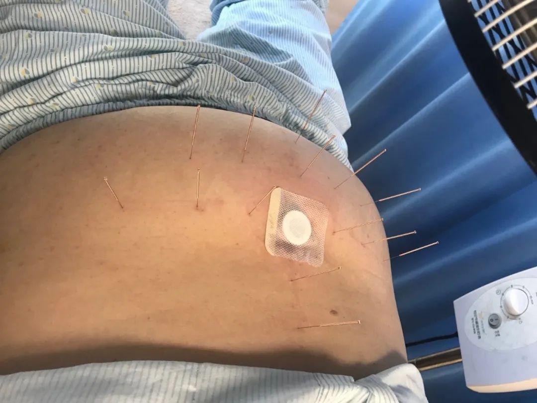 不吃药不打针有效逆转糖尿病丨中医慢病体重管理营助您实现减肥降糖双