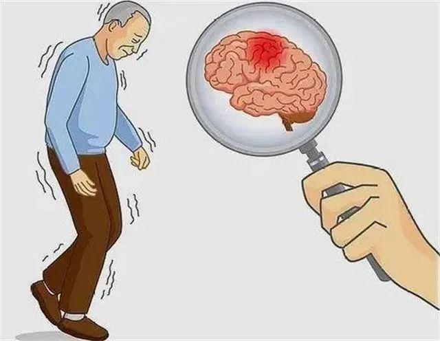 世界脑卒中日警惕卒中症状尽早识别救治