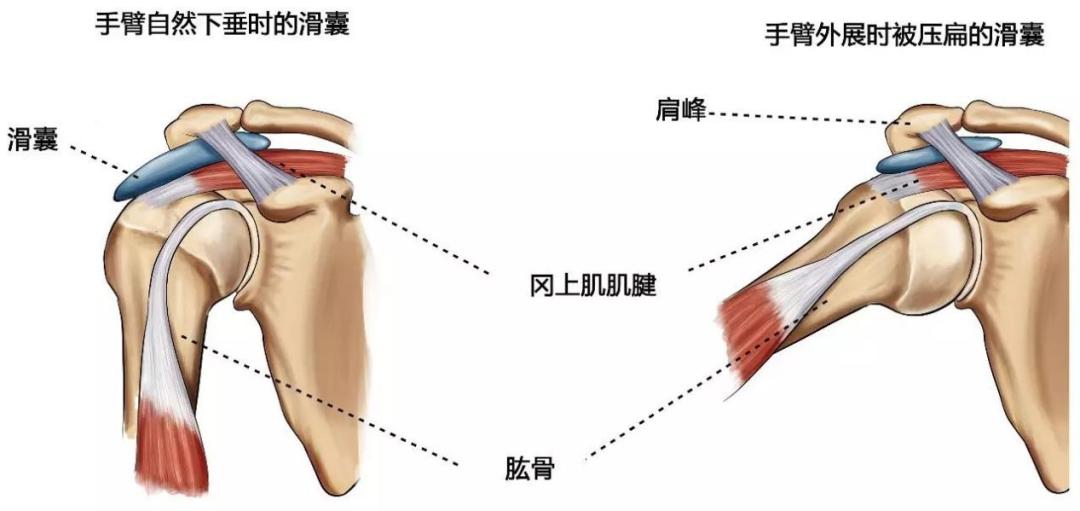 肩周炎肩袖损伤傻傻分不清楚这场爱肩义诊不要错过