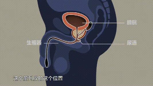 生殖器之间前列腺的位置前列腺炎及性功能障碍等问题就很容易引发一旦