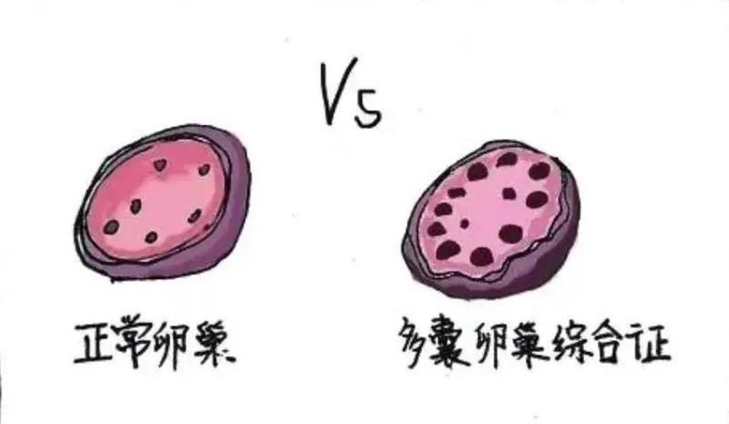 妇科医生针对此事评论道"医生需要监测卵泡发育的速度,个数,如果成熟