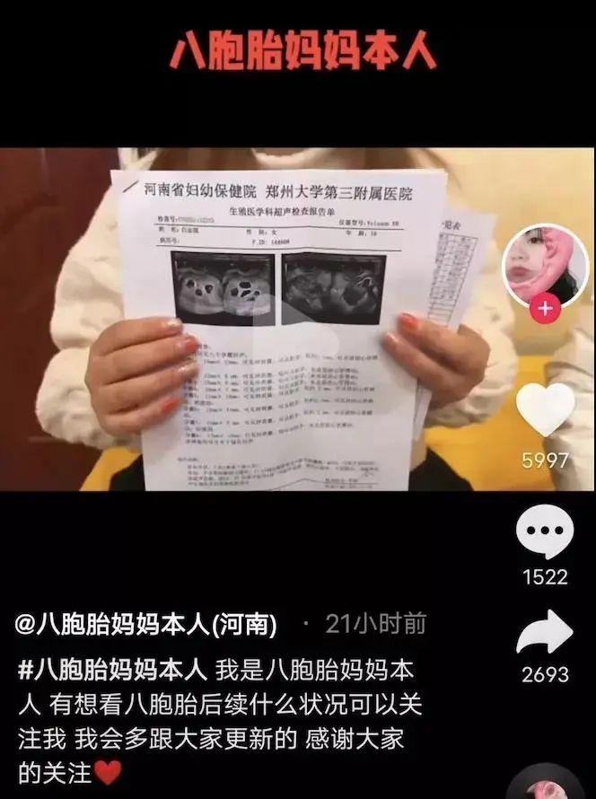 18岁怀了八胞胎她想生下来