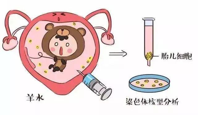 另外,孕前优生健康检查也是出生缺陷预防的重要手段哦▽点这里查看